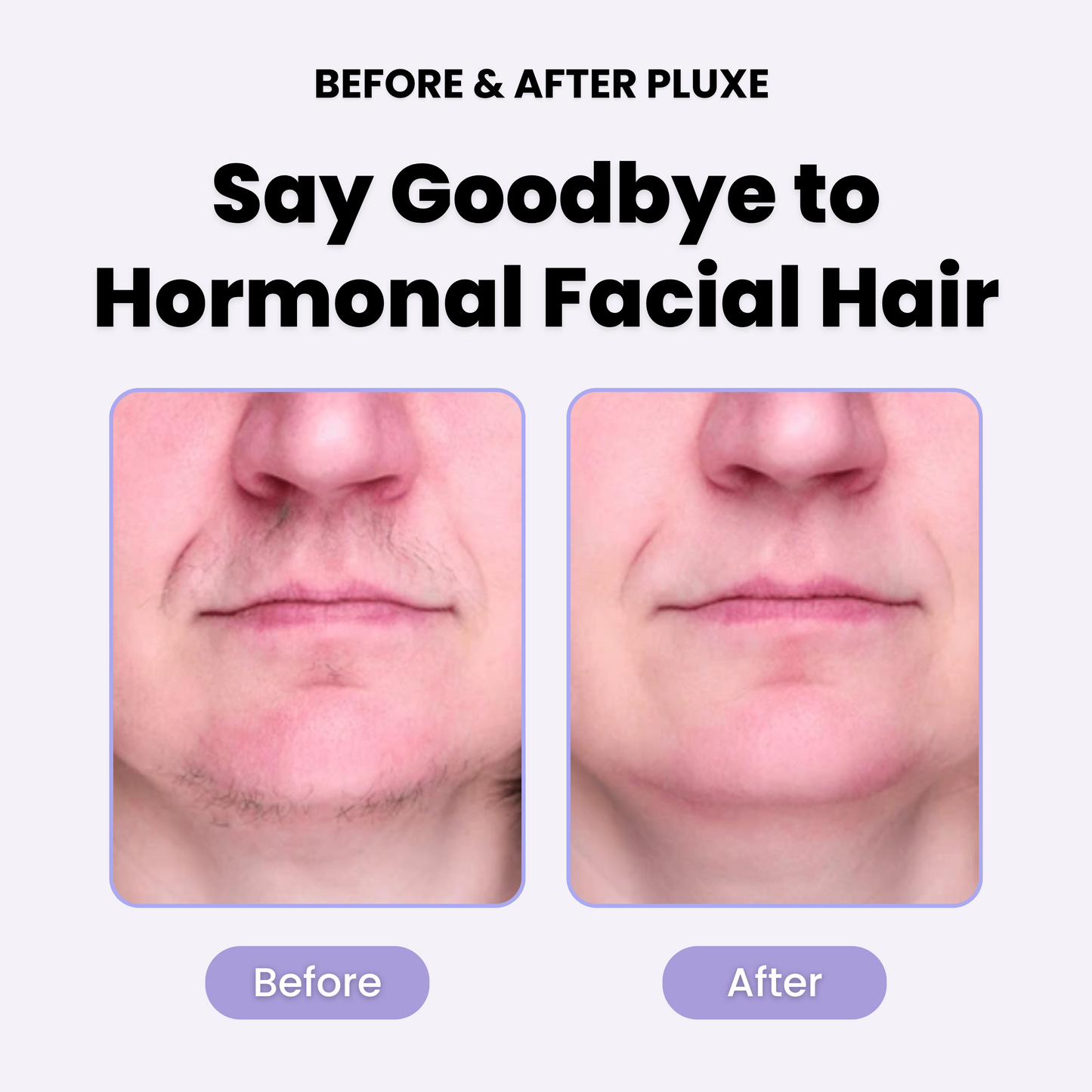 PLuxe Facial Hair Remover - 50% OFF!