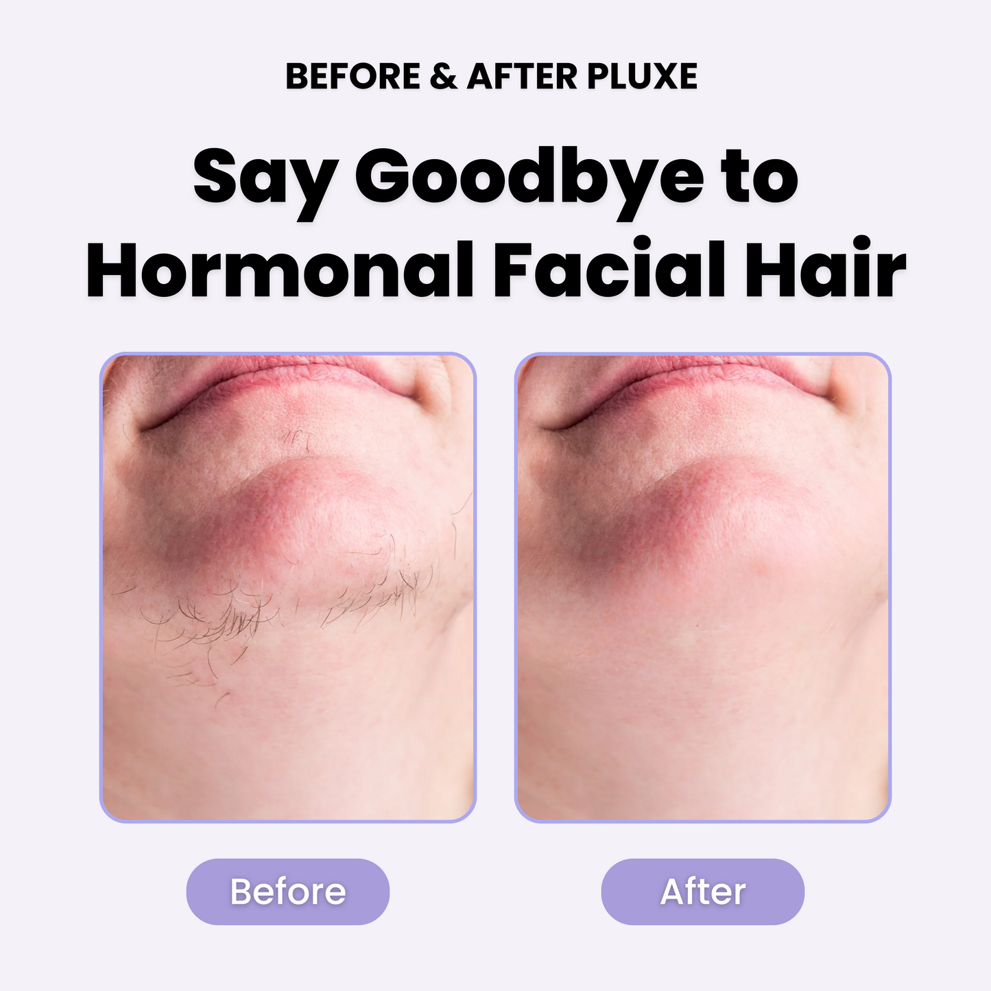 PLuxe Facial Hair Remover - 50% OFF!