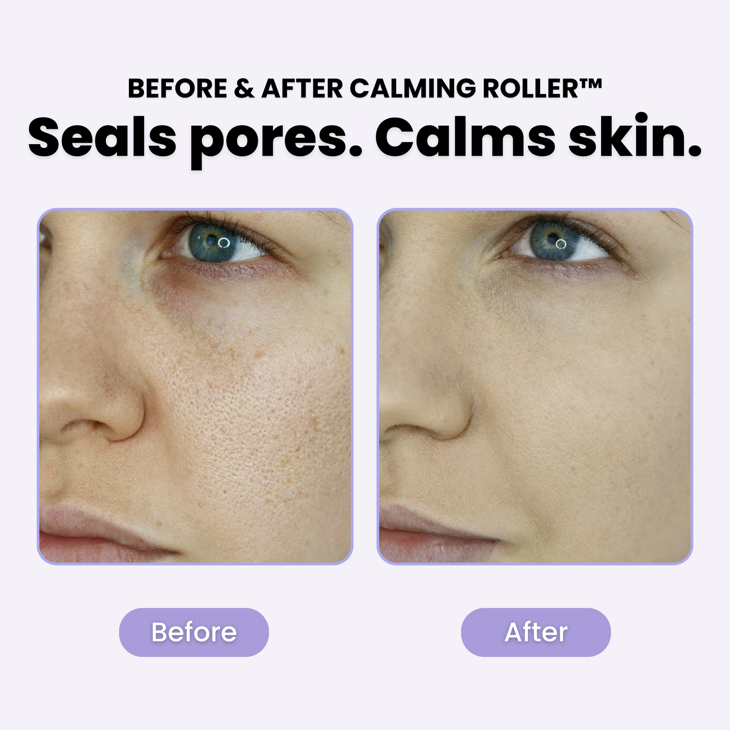 PLuxe Calming Roller™ - 50% OFF!