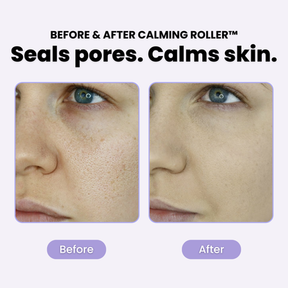 PLuxe Calming Roller™ - 50% OFF!