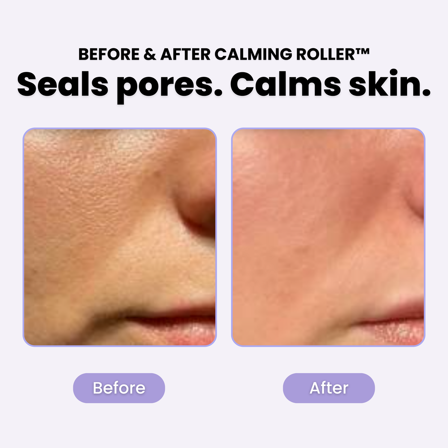 PLuxe Calming Roller™ - 50% OFF!