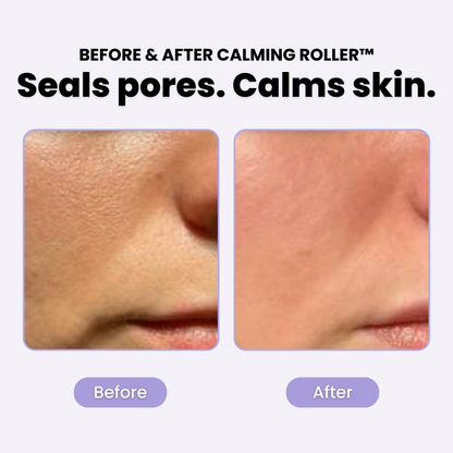 PLuxe Calming Roller™ - 50% OFF!